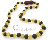 Baltic Amber Adult/Adolescent Necklace - Unpolished 2 DifferentLarger Beads