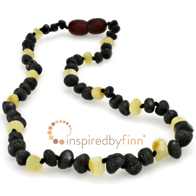 <u>SALE! Adult/Adolescent Size Baltic Amber Necklace - Unpolished Dark with Light Necklace</u>