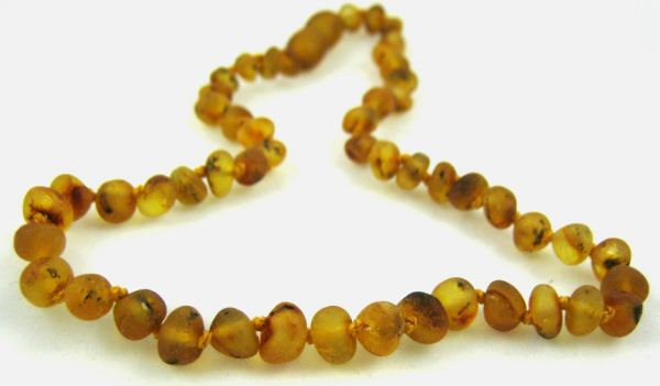 <u>Amber Necklace - Unpolished Spotted Amber - Sizes 10.5 - 18"</u>