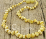 SALE! Kids Amber Teething Necklace - Polished Variegated - Sizes 10.5-15